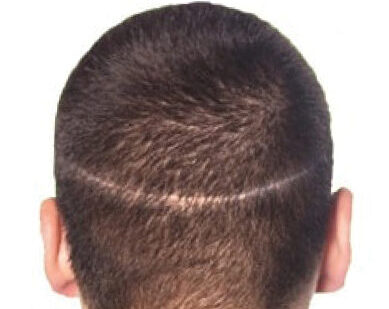 the back of a man's head