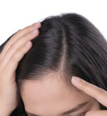 young-asian-women-worry-about-problem-hair-loss-head-bald-dandruff